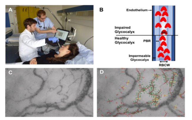 Picture with four areas. Top left shows doctors talking to a patient. Top right shows a schematic description. Lower left and right show microscope images.